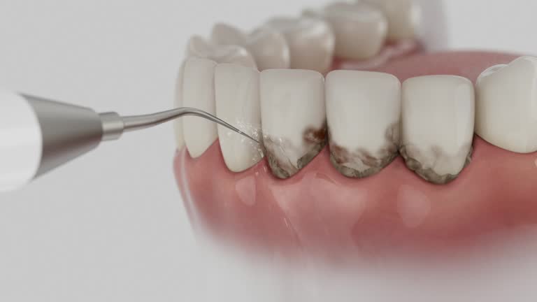 Reliable Tooth Extraction contractor in Blanchester, OH by Smile Center Dentistry